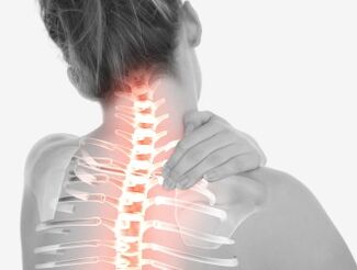 Osteocondrose da rexión do cérvix