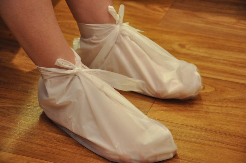 Compresas para a artrose do nocello