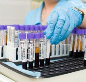 Análise de sangue para diagnosticar dor nas articulacións