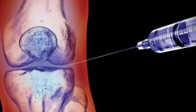 Métodos para tratar a artrose articular