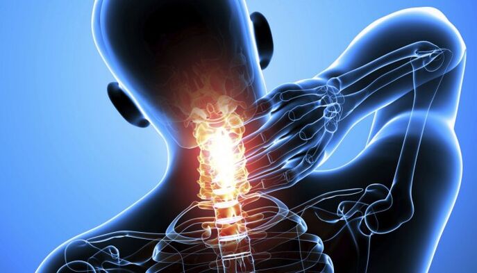 Dor na columna cervical